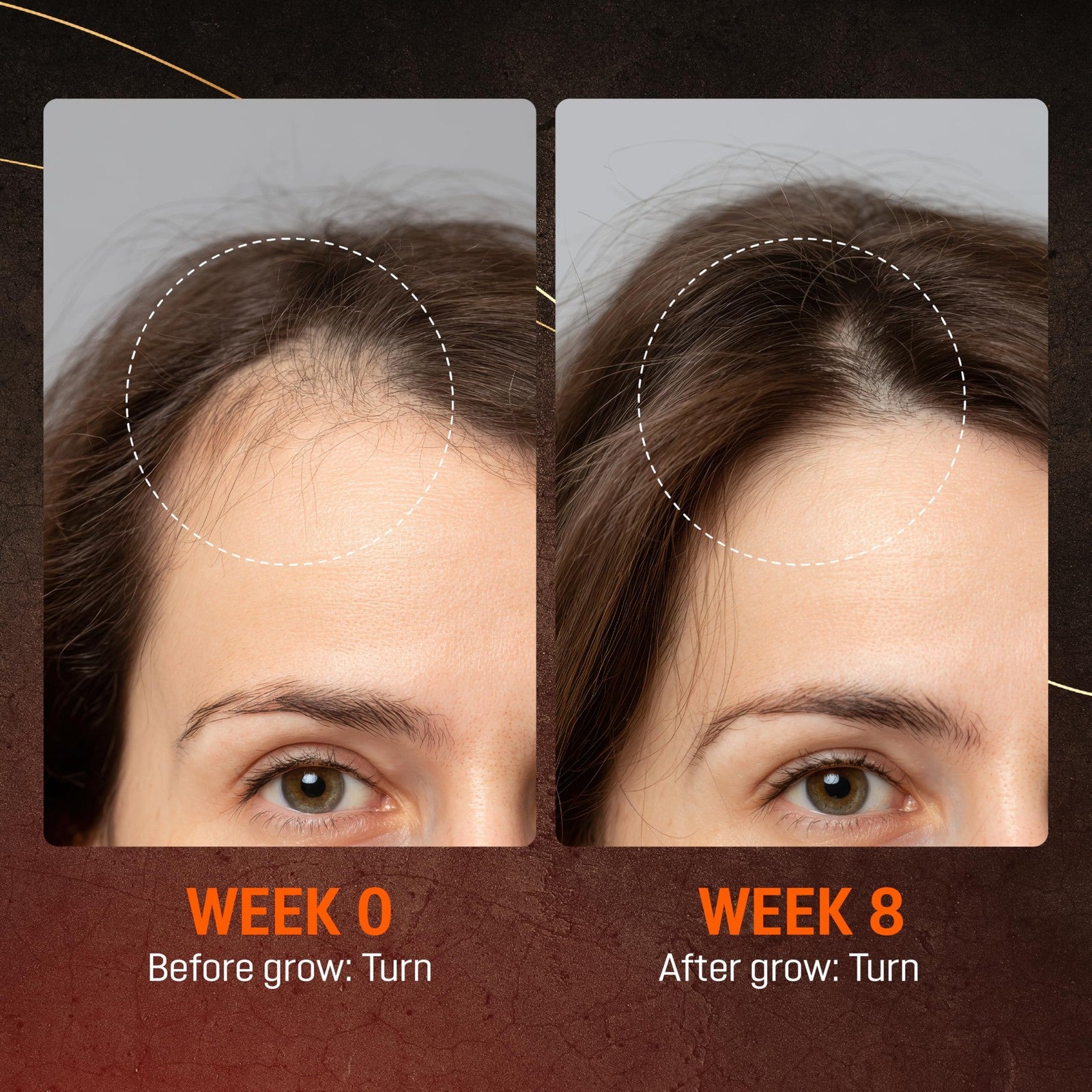 Abera Hair Growth Serum for hair loss, featuring natural ingredients, in a clear applicator bottle with serum inside.