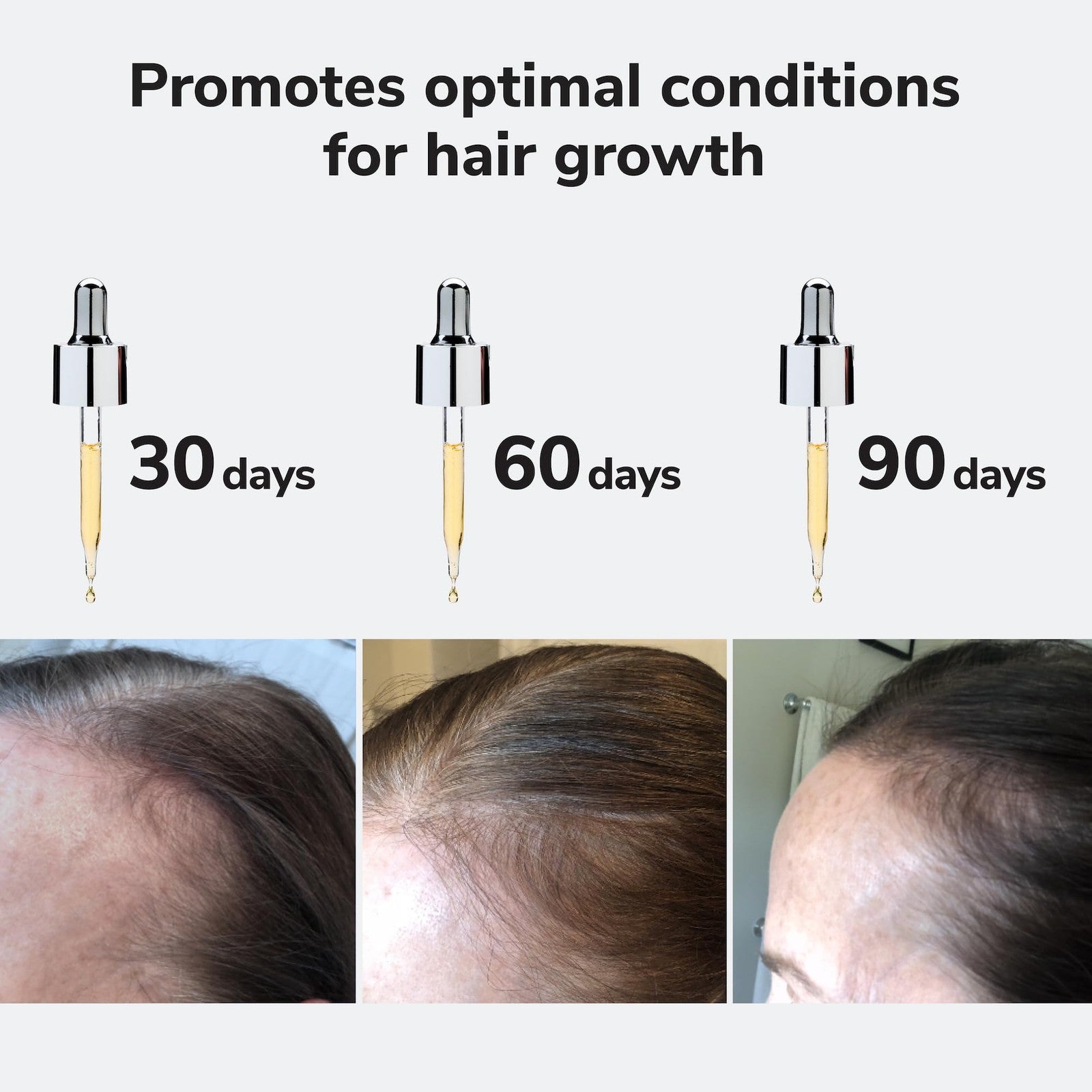 COLOR WOW Youth Juice Collagen Scalp Treatment bottle with applicator tip, designed to support scalp collagen health.
