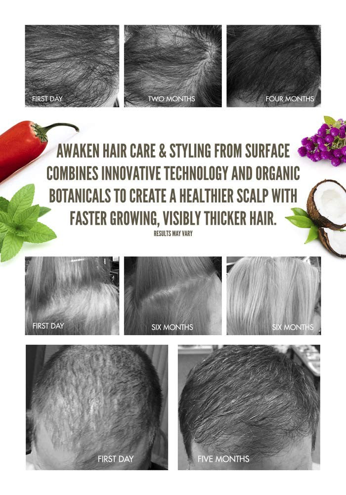 Surface Hair Awaken Therapeutic Scalp Elixir bottle with natural ingredients, designed to help with thinning hair.