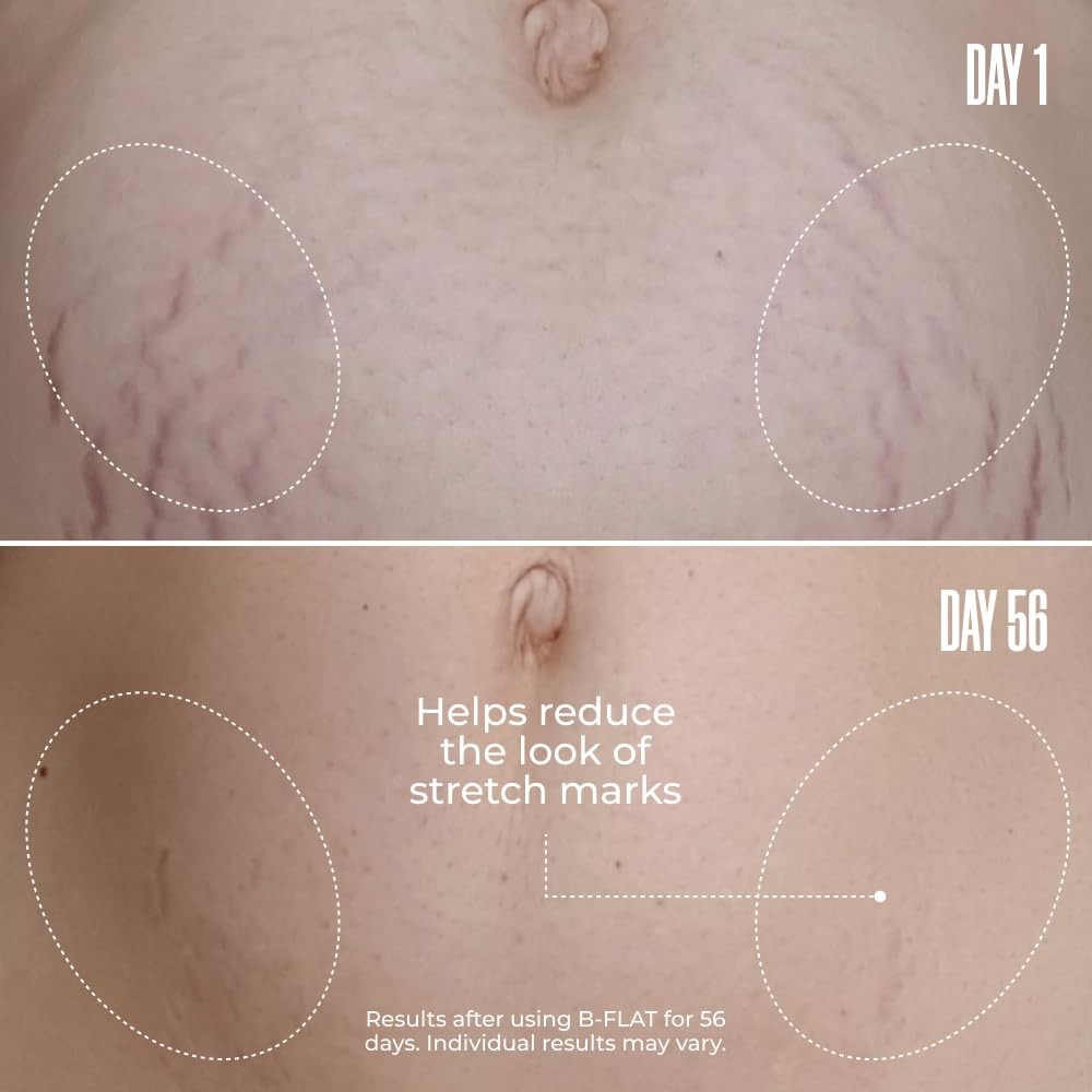 B-Flat Belly Firming Cream by Maëlys Malys Cosmetics showing a jar of stretch mark belly cream with natural ingredients.