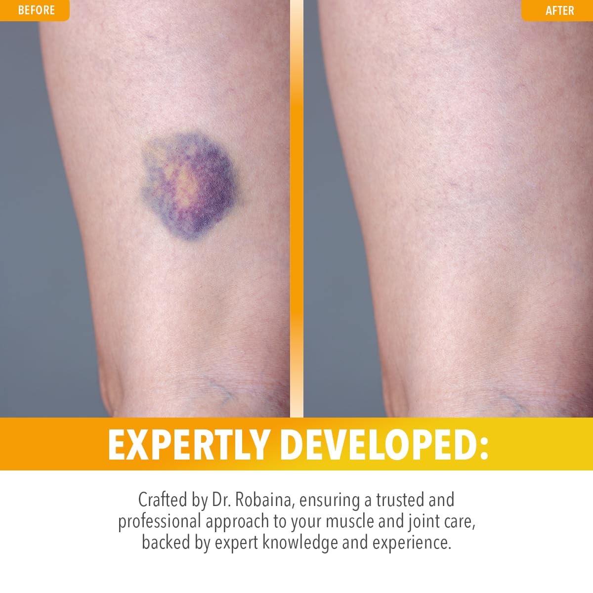 Dr. Robaina Arnica Salve balm for bruises, swelling, and muscle recovery, shown in a tube with natural herbal ingredients.