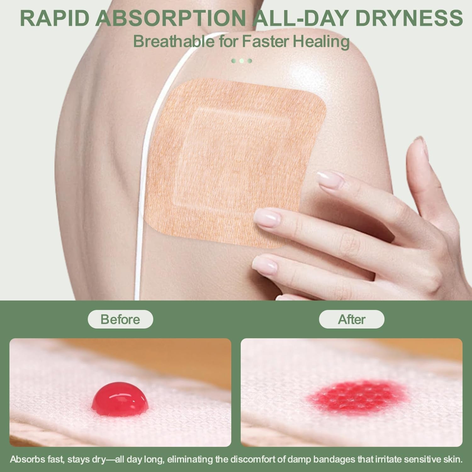 Hysimedy silicone adhesive bandages in extra large size on sensitive, fragile skin, showing soft, transparent medical dressing.