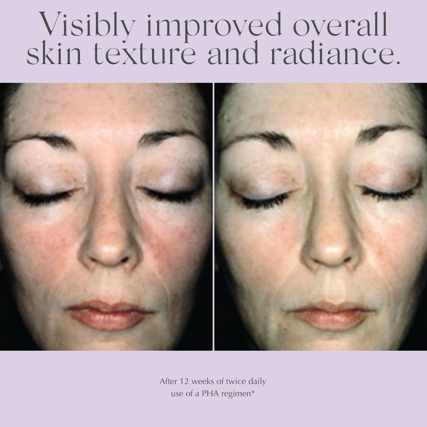 EXUVIANCE Overnight Transformation Complex hydrating night cream jar with hyaluronic acid and smooth creamy texture.