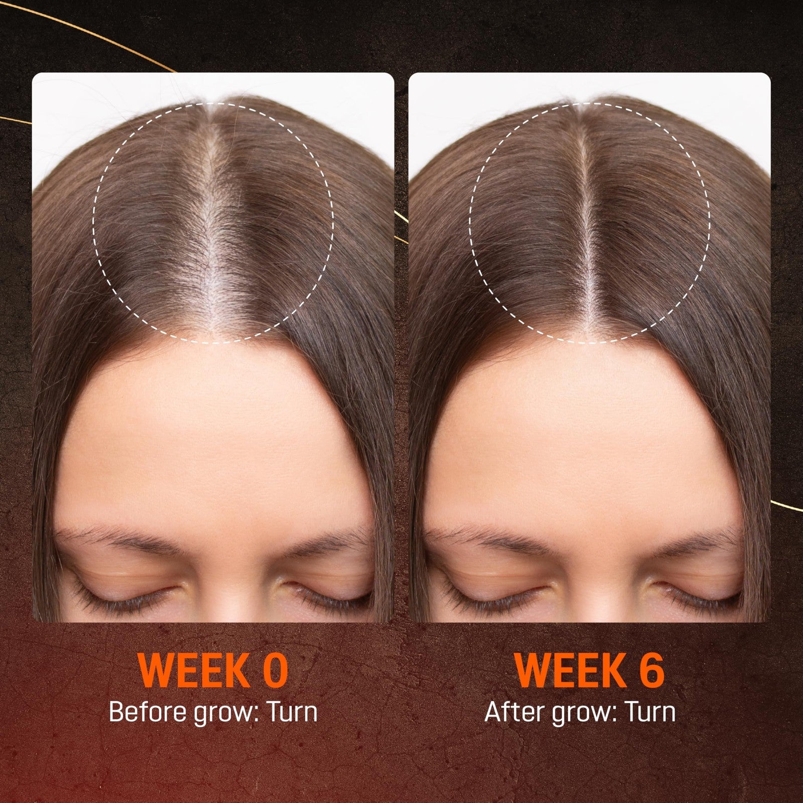 ABERA Hair Growth Serum for natural hair regrowth and hair loss treatment, featuring a clear bottle with serum and applicator brush.