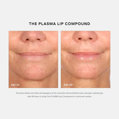 U Beauty 3-Piece Set - Resurfacing Serum, Hydrator & Lip - Product Imagery