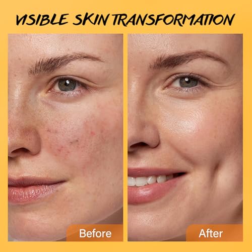 Exfoliating Face Scrub with Turmeric Vitamin C Face Exfoliator - Product Imagery