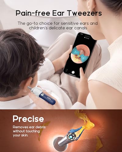 Bebird R37R Ear Wax Removal Tool Camera, Flexible Scope and - Product Imagery