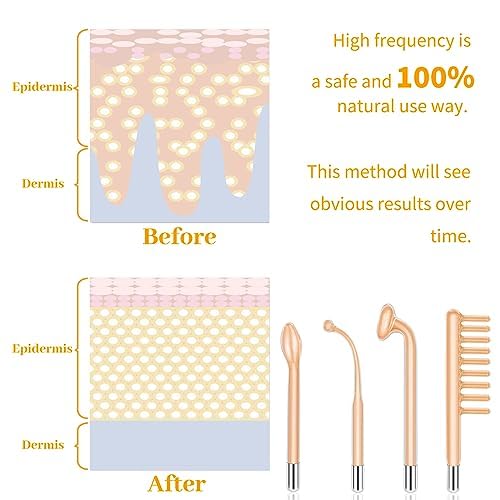Portable Beauty Tool with 4 Red Glass Wand, Personal Skin Care - Product Imagery