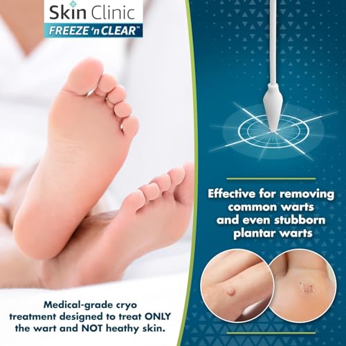 Skin Clinic Freeze 'n Clear Advanced Wart Remover - Product Imagery