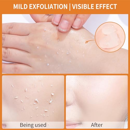 Orange Exfoliating Gel, Moisturizer Face Body Scrub Gel,Deep - Product Imagery