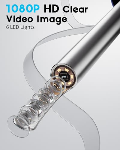 Loyker X6 Ear Wax Removal Tool Camera, FSA - HSA Store Eligible, - Product Imagery