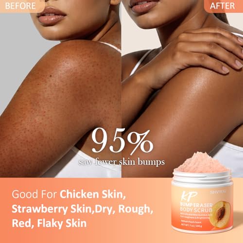 SHVYOG KP Bump Eraser Body Scrub with 10% AHA+BHA & Glycolic - Product Imagery