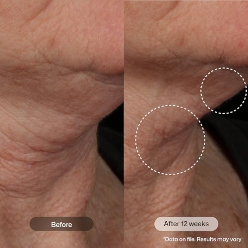 Revision Skincare Nectifirm Advanced® Neck Cream – Clinically - Product Imagery