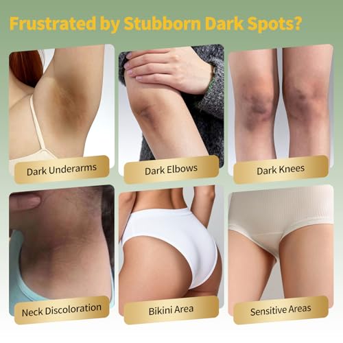Body Dark Spot Corrector & Skin Lightening Cream for Intimate - Product Imagery