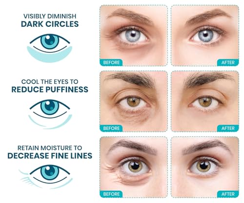 Stylia Collagen & Vitamin C Under Eye Patches for Puffy Eyes & - Product Imagery