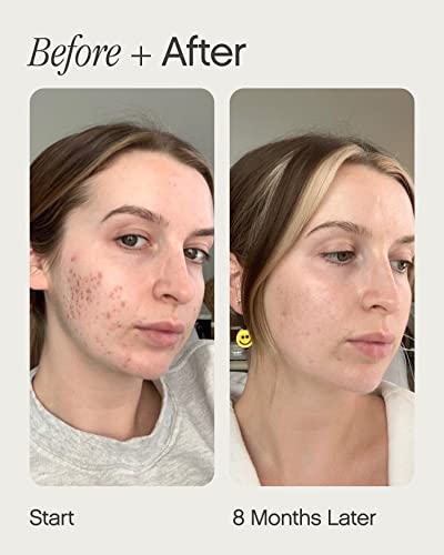Topicals, Faded Brightening Serum, Reduces Discoloration, 0.5 Fl - Product Imagery