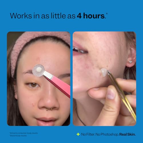 Peach Slices - Acne Spot Dots (30 ct) - Hydrocolloid Pimple - Product Imagery