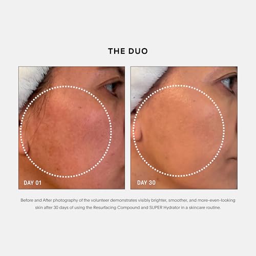 U Beauty 3-Piece Set - Resurfacing Serum, Hydrator & Lip - Product Imagery