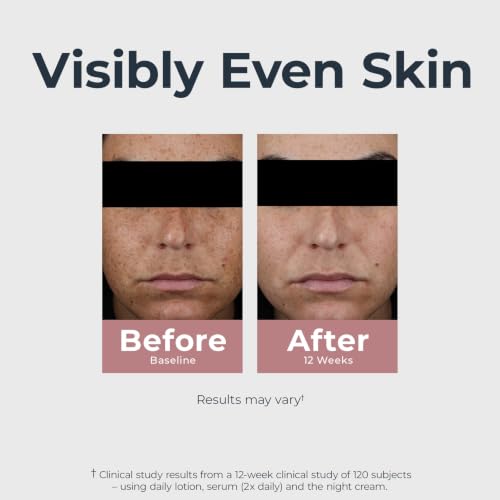 Eucerin Radiant Tone Dual Serum Dark Spot Corrector, Dark Spot - Product Imagery