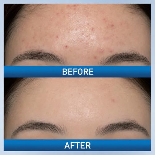 0.05% HPR Retinoid Night Cream, Anti-Aging Moisturizer with - Product Imagery