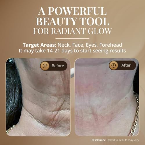 GLO24K LED Face Massager and Neck Wand - Beauty Skin Care Tool - Product Imagery