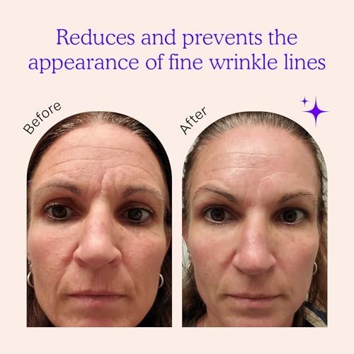 Face, Forehead Wrinkle Patches - Anti Wrinkle Facial Patches to - Product Imagery
