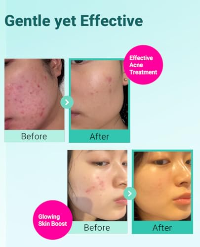 BRING GREEN TEA TREE CICA SET | Korean Skin Care Kit for - Product Imagery