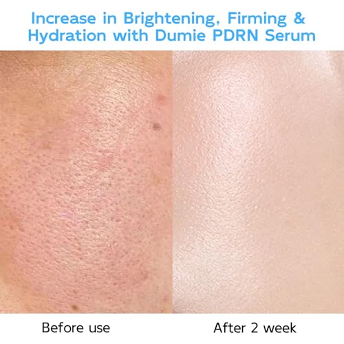 Salmon DNA PDRN Anti-Aging Serum, 5000ppm Salmon Egg DNA - Product Imagery