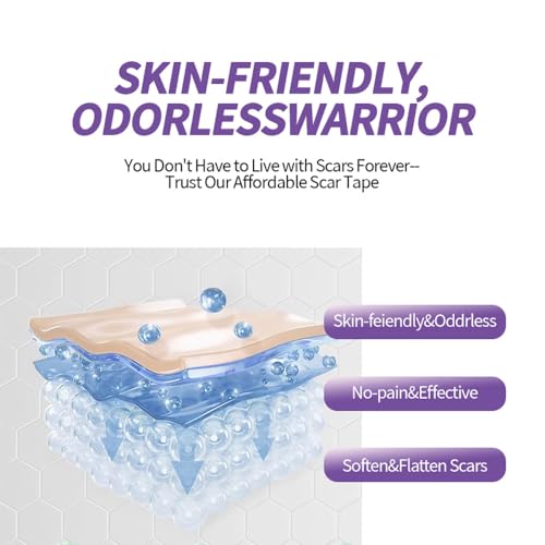 Medical Grade Silicone Scar Sheets, (1.6" x 60" Scar Roll-1.5M) - Product Imagery