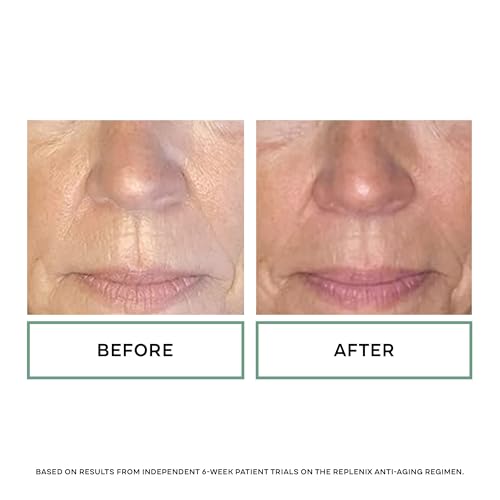 Replenix Age Restore Nighttime Therapy Face Cream, Anti-Aging - Product Imagery