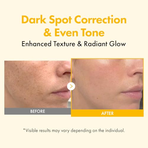 TOSOWOONG Ultimate Dark Spot Care Routine - 80% Turmeric Peel - Product Imagery