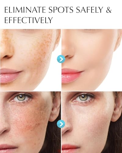 EnaSkin Dark Spot Corrector Cream & Remover for Face & Body, - Product Imagery