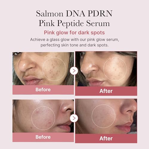 medicube Viral Serum Duo for Clear and Plump Skin: Kojic Acid - Product Imagery