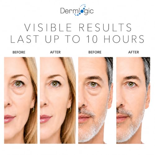 Under Eye Puffiness & Dark Circles Rapid Treatment- Instantly - Product Imagery