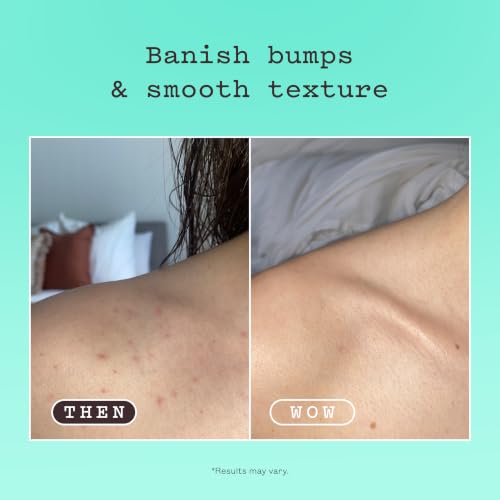 frank body Glycolic Acid Body Scrub | Fights KP & Breakouts, - Product Imagery