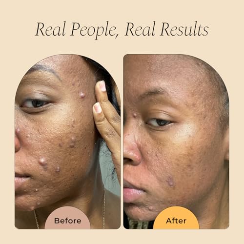 Glo Melanin Turmeric & Kojic Foaming Face Wash - 120ml - Product Imagery