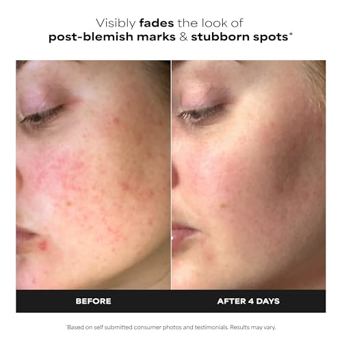 Paula's Choice BOOST 10% Azelaic Acid Booster Cream Gel Serum - Product Imagery