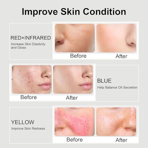 Red Light Therapy Mask for Face with 2600mAh Rechargeable Remote - Product Imagery
