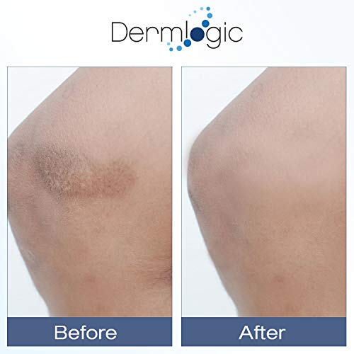 Vitamin K Cream- Moisturizing Bruise Healing Formula. Dark Spot - Product Imagery