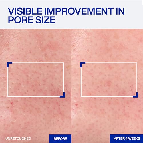 IOPE Expert Retinol RX 1% Super Bounce Serum - Gentle Anti-Aging - Product Imagery