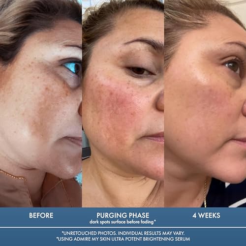 Admire My Skin Dark Spot Corrector Remover for Face Brightening - Product Imagery