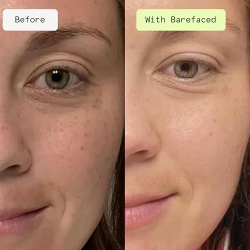 Barefaced Brightening Serum Dark Spot Corrector | Kojic Acid, - Product Imagery