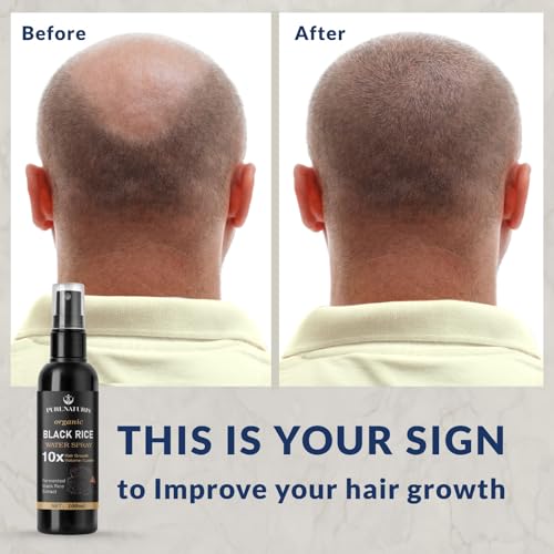 Castor oil Ginger Rice Water for Hair Growth Serum - Leave-In - Product Imagery