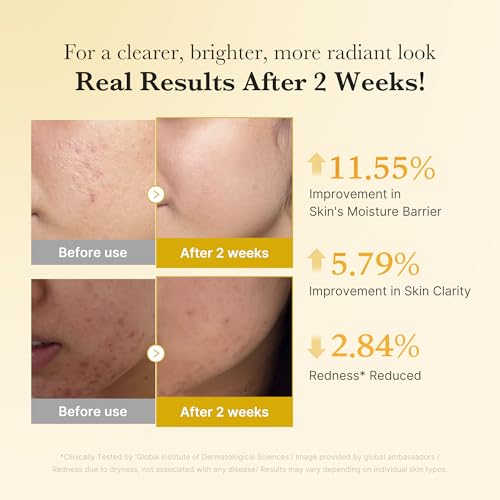 medicube Kojic Acid Turmeric Clarifying Capsule Serum for - Product Imagery
