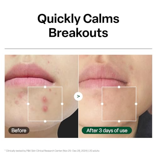 Dr.G R.E.D. Blemish Clear Hyal-Cica Facial Serum, 1.69 fl oz - Product Imagery