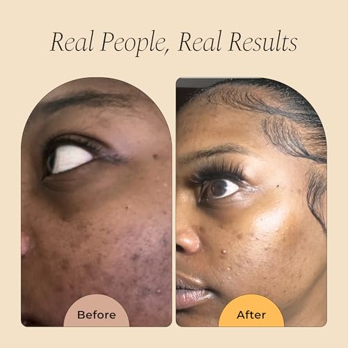 Glo Melanin Nourishing Face Cream – Hydrating Daily Moisturizer - Product Imagery