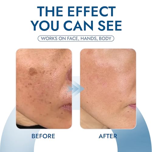 Claranova Lavouria Age Spot Cream, Dark Spot Corrector for Face, - Product Imagery