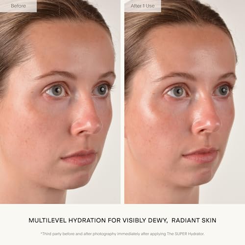 U Beauty The SUPER Hydrator - Mega-Dose Skin Hydrator and - Product Imagery