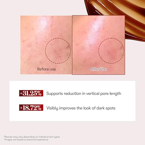 VT COSMETICS Red Booster Reedle Shot 100 Serum, 1.69 fl oz (50ml) - Product Imagery