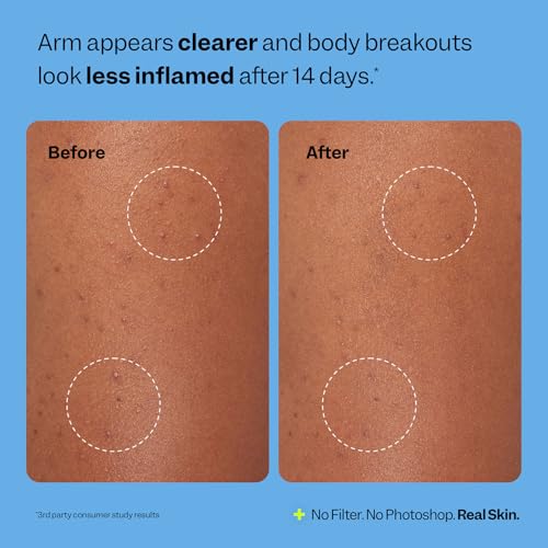 Peach Slices - Body Breakout Patches (6 ct) - Overnight Body - Product Imagery